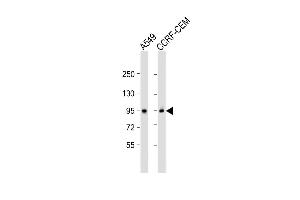 All lanes : Anti-CD71 Antibody (C-term) at 1:2000 dilution Lane 1: A549 whole cell lysate Lane 2: CCRF-CEM whole cell lysate Lysates/proteins at 20 μg per lane. (Transferrin Receptor anticorps  (C-Term))
