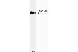 Western blot analysis of DNA Topoisomerase I. (Topoisomerase I anticorps)