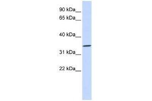 RHCE antibody used at 1 ug/ml to detect target protein.