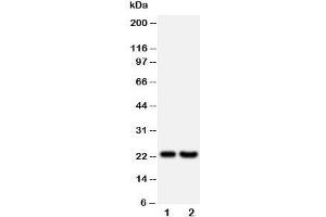 Western blot testing of FGF9 antibody and Lane 1:  rat brain;  2: HeLa;  Predicted size: 23KD;  Observed size: 23KD (FGF9 anticorps  (Middle Region))