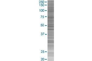 ANGPTL7 transfected lysate.