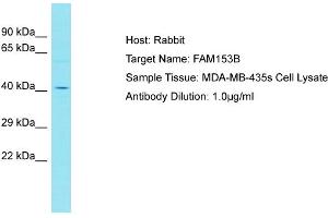 Host: Rabbit Target Name: FAM153B Sample Type: MDA-MB-435s Whole cell lysates Antibody Dilution: 1. (FAM153B anticorps  (C-Term))