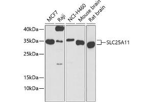 Western blot analysis of extracts of various cell lines, using SLC25 antibody (ABIN6132660, ABIN6147903, ABIN6147904 and ABIN6224187) at 1:1000 dilution.