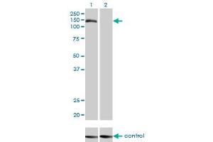 Western blot analysis of TMEM1 over-expressed 293 cell line, cotransfected with TMEM1 Validated Chimera RNAi (Lane 2) or non-transfected control (Lane 1). (TRAPPC10 anticorps  (AA 1162-1257))