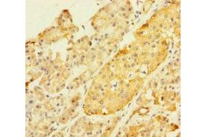 Immunohistochemistry of paraffin-embedded human pancreatic tissue using ABIN7176608 at dilution of 1:100 (ZKSCAN2 anticorps  (AA 1-300))