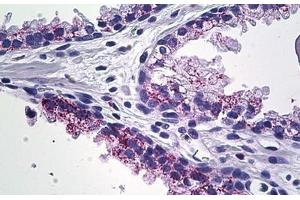 Human Prostate: Formalin-Fixed, Paraffin-Embedded (FFPE) (MMP23B anticorps  (C-Term))