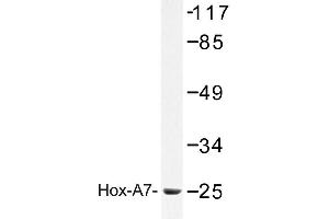 Image no. 1 for anti-Homeobox A7 (HOXA7) antibody (ABIN272304) (HOXA7 anticorps)