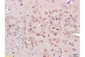 Formalin-fixed and paraffin embedded rat brain tissue labeled with Anti-LLGL1/2 Polyclonal Antibody, Unconjugated (ABIN761966) at 1:200 followed by conjugation to the secondary antibody and DAB staining (LLGL1 anticorps  (AA 801-900))