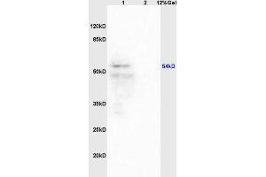 Lane 1: mouse brain lysates Lane 2: mouse heart lysates probed with Anti Iroquois homeobox protein 3 Polyclonal Antibody, Unconjugated (ABIN872921) at 1:200 in 4 °C.