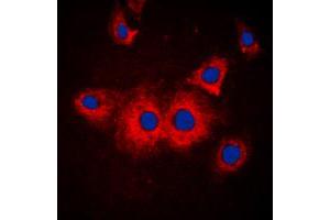 Immunofluorescent analysis of SLK staining in MCF7 cells. (SLK anticorps  (C-Term))