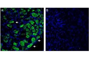 Expression of Plexin-C1 in in rat dorsal root ganglion. (Plexin C1 anticorps  (Extracellular))