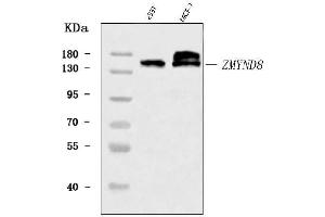 Western blot analysis of ZMYND8 using anti-ZMYND8 antibody (ABIN7598947).