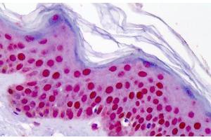 Human Skin: Formalin-Fixed, Paraffin-Embedded (FFPE) (Aryl Hydrocarbon Receptor anticorps  (AA 2-51))