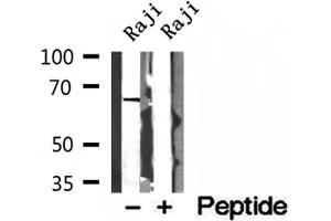 Western blot analysis of extracts of Raji cells, using MTA3 antibody.