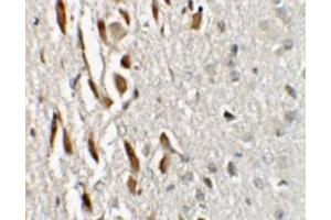 Immunohistochemistry (IHC) image for anti-Teashirt Zinc Finger Homeobox 3 (TSHZ3) (N-Term) antibody (ABIN1031649) (TSHZ3 anticorps  (N-Term))