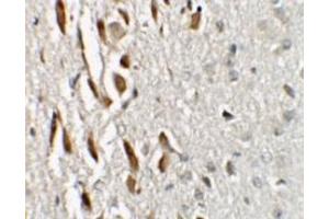 Immunohistochemistry (IHC) image for anti-Zinc Finger Protein 537 (ZNF537) (N-Term) antibody (ABIN1031649) (TSHZ3 anticorps  (N-Term))