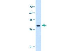 Western Blot analysis of Jurkat cell lysate with IFI44L polyclonal antibody  at 5 ug/mL working concentration. (IFI44L anticorps  (N-Term))