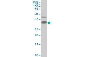 TSPAN32 monoclonal antibody (M02), clone 2B4 Western Blot analysis of TSPAN32 expression in Hela S3 NE .