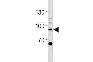 STAT-3 antibody western blot analysis in Daudi lysate.