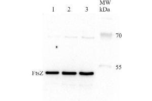 Western Blotting (WB) image for anti-Procaryotic Cell Division Gtpase (Ftsz) antibody (ABIN2749235) (Ftsz anticorps)