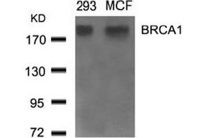 Image no. 2 for anti-Breast Cancer 1 (BRCA1) (Ser1524) antibody (ABIN401620) (BRCA1 anticorps  (Ser1524))