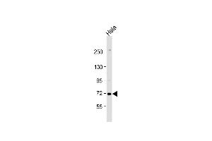 Anti-ZDHHC17 Antibody (N-Term) at 1:1000 dilution + Hela whole cell lysate Lysates/proteins at 20 μg per lane.