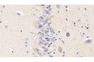 Detection of TF in Bovine Cerebellum Tissue using Polyclonal Antibody to Tissue Factor (TF)