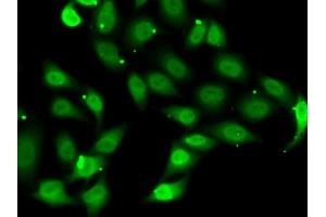Immunofluorescence analysis of MCF7 cells using TE antibody (ABIN6129489, ABIN6148983, ABIN6148985 and ABIN6222505). (TEAD1 anticorps  (AA 135-215))