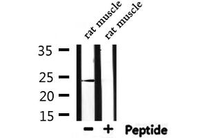 Western blot analysis of extracts from rat muscle, using PGF Antibody.