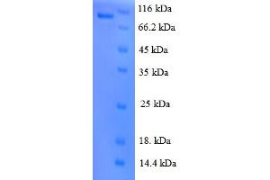 SDS-PAGE (SDS) image for VEGF Receptor 2 (VEGFR2) (AA 20-764), (Extracellular) protein (GST tag) (ABIN5709799)