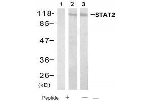 Image no. 1 for anti-Signal Transducer and Activator of Transcription 2, 113kDa (STAT2) (Tyr690) antibody (ABIN319409)