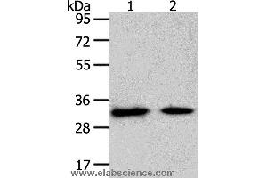 Western blot analysis of Mouse heart and muscle tissue, using SLC25A4 Polyclonal Antibody at dilution of 1:400 (SLC25A4 anticorps)