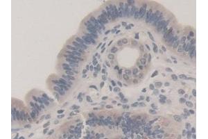 Detection of TUBb1 in Mouse Uterus Tissue using Polyclonal Antibody to Tubulin Beta 1 (TUBb1) (TUBB1 anticorps  (AA 182-437))