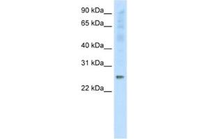 Western Blotting (WB) image for anti-Synaptosomal-Associated Protein, 25kDa (SNAP25) antibody (ABIN2463769) (SNAP25 anticorps)
