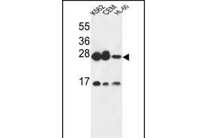 ANP32A Antibody (C-term) (ABIN6243481 and ABIN6579058) western blot analysis in K562,CEM,HL-60 cell line lysates (35 μg/lane).