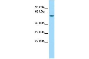 Host: Rabbit Target Name: MMP27 Sample Type: Fetal Lung lysates Antibody Dilution: 1. (MMP27 anticorps  (Middle Region))