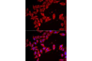 Immunofluorescence analysis of HeLa cells using SLC35 antibody (ABIN6133144, ABIN6147991, ABIN6147992 and ABIN6223068).