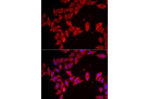 Immunofluorescence analysis of HeLa cells using SLC35 antibody (ABIN6133144, ABIN6147991, ABIN6147992 and ABIN6223068). (SLC35A2 anticorps  (AA 1-242))