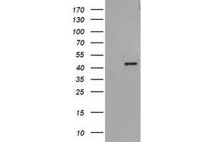 Western Blotting (WB) image for anti-Alcohol Dehydrogenase 1B (Class I), beta Polypeptide (ADH1B) antibody (ABIN1496477)