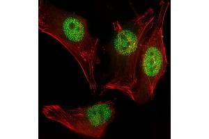 Immunofluorescent analysis of 4 % paraformaldehyde-fixed, 0.