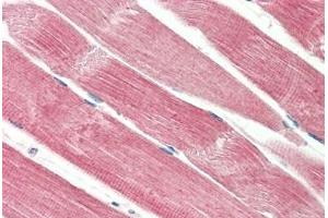 Human Skeletal Muscle: Formalin-Fixed, Paraffin-Embedded (FFPE) (THNSL2 anticorps  (AA 82-94))