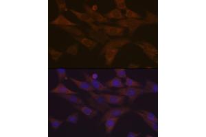 Immunofluorescence analysis of NIH-3T3 cells using PKC delta Rabbit mAb  at dilution of 1:100 (40x lens). (PKC delta anticorps)