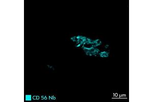 Immunofluorescence staining of human appendix tissue sample.