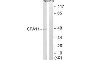 Western blot analysis of extracts from HT-29 cells, using SERPINA11 Antibody. (SERPINA11 anticorps  (AA 191-240))
