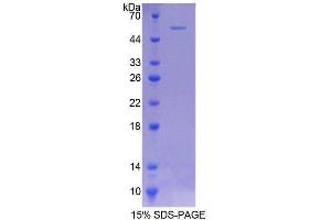 SDS-PAGE analysis of Rat COQ6 Protein. (COQ6 Protéine)