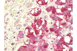 anti-serine Palmitoyltransferase, Long Chain Base Subunit 2 (SPTLC2) (C-Term) antibody