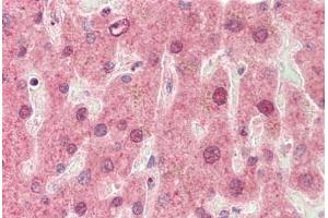 Human, Liver: Formalin-Fixed Paraffin-Embedded (FFPE)