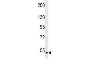 Western blot analysis of ZAK antibody and HepG2 lysate.