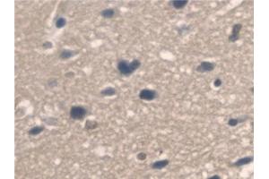 Detection of PNPO in Mouse Cerebrum Tissue using Polyclonal Antibody to Pyridoxamine-5'-Phosphate Oxidase (PNPO) (PNPO anticorps  (AA 1-261))