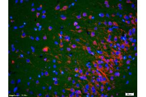 Formalin-fixed and paraffin-embedded rat brain labeled with Anti-ACTH (18-39) Polyclonal Antibody, Unconjugated (ABIN668661) 1:200, overnight at 4°C, The secondary antibody was Goat Anti-Rabbit IgG, Cy3 conjugated used at 1:200 dilution for 40 minutes at 37°C. (ACTH anticorps  (AA 18-39))